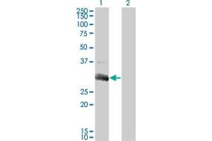 Western Blot analysis of DGUOK expression in transfected 293T cell line by DGUOK monoclonal antibody (M02), clone 3E9.