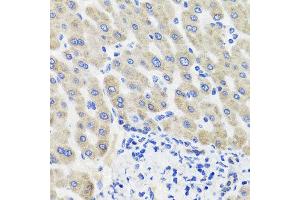 Immunohistochemistry of paraffin-embedded human liver injury using HSD11B2 antibody at dilution of 1:100 (x40 lens).
