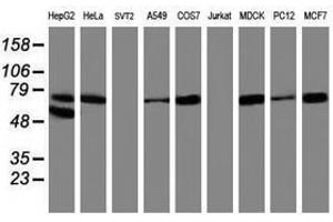 Image no. 8 for anti-Arachidonate 15-Lipoxygenase (ALOX15) antibody (ABIN1496359)