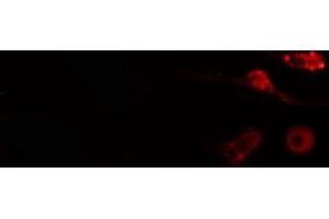 ABIN6275036 staining  COLO205 cells by IF/ICC. (NCAPH antibody  (Internal Region))
