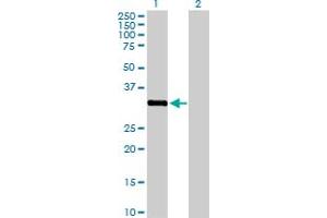 Western Blot analysis of STK16 expression in transfected 293T cell line by STK16 MaxPab polyclonal antibody. (STK16 antibody  (AA 1-305))