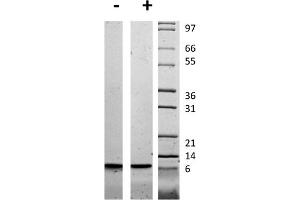 SDS-PAGE of Human Insulin-like Growth Factor II Recombinant Protein SDS-PAGE of Human Insulin-like Growth Factor II Recombinant Protein. (IGF2 Protein)