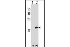 Western blot analysis of COTL1 (arrow) using rabbit polyclonal COTL1 Antibody (C-term) (ABIN652766 and ABIN2842503). (COTL1 antibody  (C-Term))