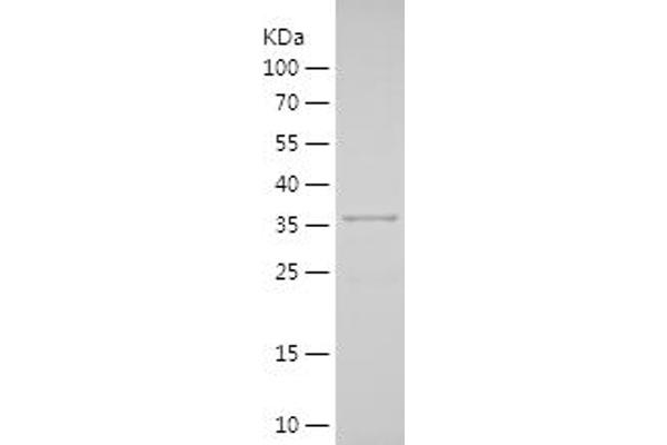 SOX17 Protein (AA 218-414) (His tag)