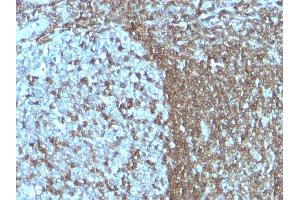 Formalin-fixed, paraffin-embedded human Tonsil stained with CD50 Monoclonal Antibody (SPM505) (ICAM-3/CD50 antibody)