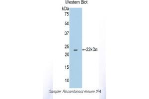 Detection of Recombinant tPA, Mouse using Polyclonal Antibody to Tissue Plasminogen Activator (tPA) (PLAT antibody  (AA 359-532))