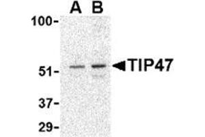 Western blot analysis of TIP47 in Daudi cell lysate with this product at (A) 0. (PLIN3 antibody  (C-Term))