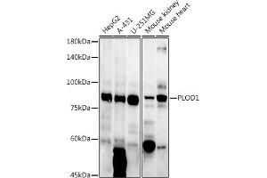 Western blot analysis of extracts of various cell lines, using PLOD1 antibody (ABIN6127272, ABIN6145784, ABIN6145786 and ABIN6223913) at 1:1000 dilution. (PLOD1 antibody  (AA 488-727))