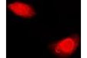 Immunofluorescent analysis of Periplakin staining in U2OS cells. (PPL antibody)