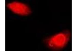 Immunofluorescent analysis of Periplakin staining in U2OS cells. (PPL antibody)