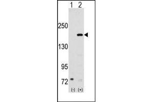 Western blot analysis of SRC1 (arrow) using rabbit polyclonal SRC1 Antibody (NCOA1 antibody  (N-Term))