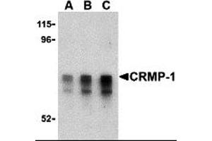 Western Blotting (WB) image for anti-Collapsin Response Mediator Protein 1 (CRMP1) (Middle Region) antibody (ABIN1030908) (CRMP1 antibody  (Middle Region))