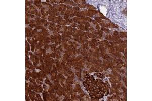 Immunohistochemical staining of human pancreas with SETD6 polyclonal antibody  shows strong cytoplasmic positivity in exocrine glandular cells and islets of Langerhans.
