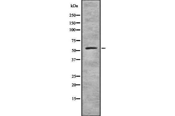 ZNF497 antibody