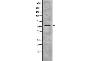 Western blot analysis of ZNF497 expression in HEK293 cells ,The lane on the left is treated with the antigen-specific peptide. (ZNF497 antibody)