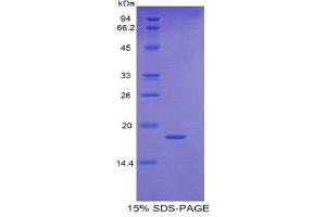 SDS-PAGE (SDS) image for Retinol Binding Protein 5, Cellular (RBP5) (AA 2-135) protein (His tag) (ABIN2122017)