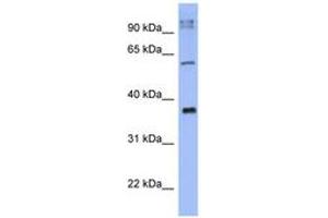 Image no. 1 for anti-BTB (POZ) Domain-Containing Protein KCTD4 (KCTD4) (AA 35-84) antibody (ABIN6741637) (KCTD4 antibody  (AA 35-84))