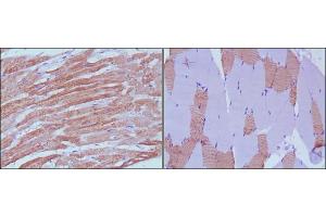 Immunohistochemical analysis of paraffin-embedded human skeletal muscle (left) and cardiac muscle (right) using MYL3 antibody with DAB staining. (MYL3/CMLC1 antibody)
