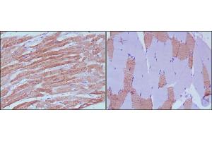 Immunohistochemical analysis of paraffin-embedded human skeletal muscle (left) and cardiac muscle (right) using MYL3 antibody with DAB staining.