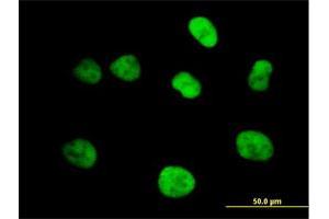 Immunofluorescence of purified MaxPab antibody to MCM4 on HeLa cell.