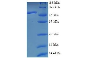 SDS-PAGE (SDS) image for Adenosine Deaminase (ADA) (AA 1-333) protein (His tag) (ABIN7583357)