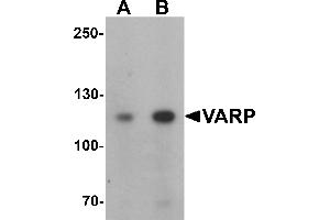 Western blot analysis of VARP in K562 cell lysate with VARP antibody at (A) 1 and (B) 2 µg/mL.