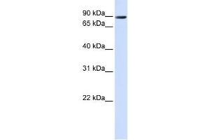 Human 293T; WB Suggested Anti-TMEM16K Antibody Titration: 0.
