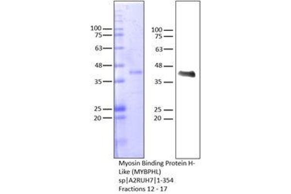 MYBPHL Protein (AA 1-354) (His tag)