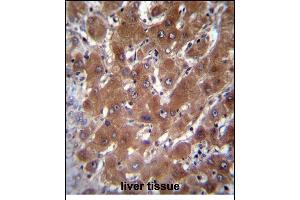 GBA3 Antibody (C-term) (ABIN656223 and ABIN2845539) immunohistochemistry analysis in formalin fixed and paraffin embedded human liver tissue followed by peroxidase conjugation of the secondary antibody and DAB staining.