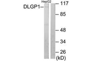 Western blot analysis of extracts from HepG2 cells, using DLGP1 Antibody.