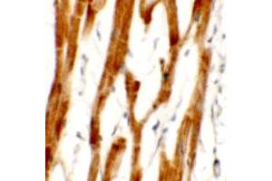 Immunohistochemical anyalysis of human heart tissue with FCHO2 polyclonal antibody  at 2.