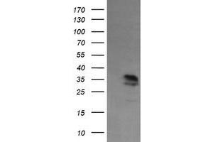 Image no. 2 for anti-Kinesin Family Member 25 (KIF25) antibody (ABIN1499040) (KIF25 antibody)
