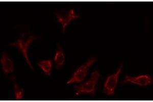 ABIN6276801 staining Hela cells by IF/ICC. (GRK2 antibody  (Internal Region))