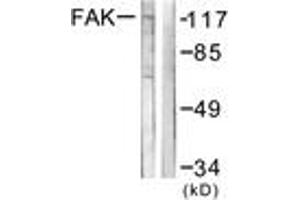 Western Blotting (WB) image for anti-PTK2 Protein tyrosine Kinase 2 (PTK2) (AA 542-591) antibody (ABIN2888628) (FAK antibody  (AA 542-591))