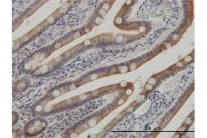 Immunoperoxidase of monoclonal antibody to CSNK1G1 on formalin-fixed paraffin-embedded human small Intestine. (CSNK1G1 antibody  (AA 293-393))