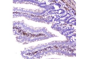 IHC analysis of Hsp27 using anti-Hsp27 antibody (ABIN6719322). (HSP27 antibody  (AA 1-209))