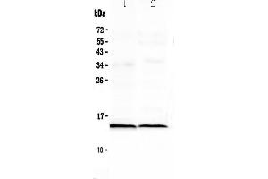 Western blot analysis of Cardiac FABP using anti-Cardiac FABP antibody .