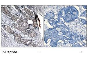Image no. 1 for anti-Tumor Protein P53 (TP53) (pSer6) antibody (ABIN319211)