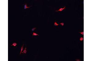 ABIN6266838 staining MCF-7 cells by IF/ICC. (DUSP16 antibody  (Internal Region))