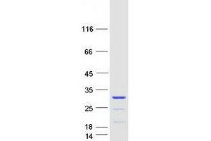 Validation with Western Blot (CCDC140 Protein (Coiled coil domain) (Myc-DYKDDDDK Tag))