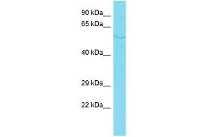Host: Rabbit Target Name: PDZD7 Sample Type: HepG2 Whole Cell lysates Antibody Dilution: 1. (PDZD7 antibody  (C-Term))