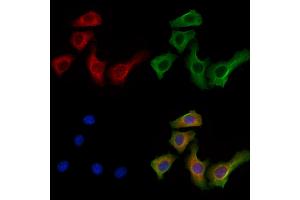 ABIN7094321 and ABIN7098368 staining Hela cells by IF/ICC. (KIF19 antibody  (Internal Region))