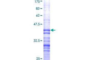 Image no. 1 for Heat Shock 22kDa Protein 8 (HSPB8) (AA 1-120) protein (GST tag) (ABIN1307225) (HSPB8 Protein (AA 1-120) (GST tag))