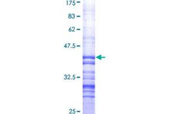 HSPB8 Protein (AA 1-120) (GST tag)