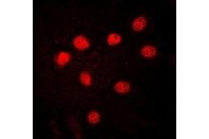 Immunofluorescent analysis of HMGB1 staining in HuvEc cells. (HMGB1 antibody)