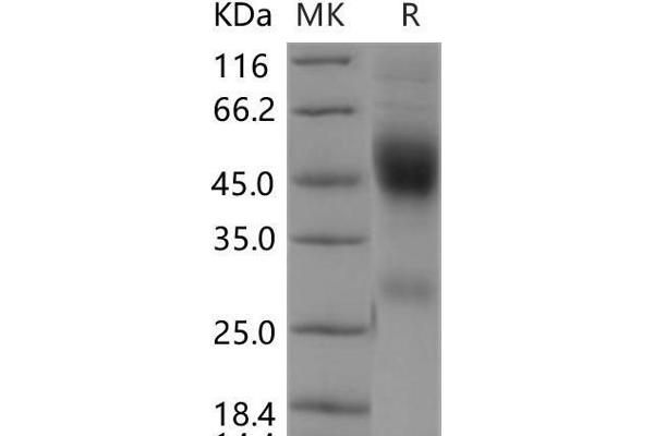 Neurexophilin 1 Protein (NXPH1) (His tag)