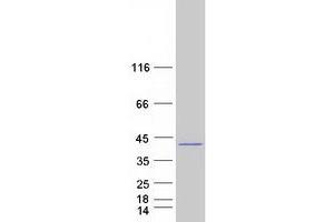 Validation with Western Blot (Syntaxin 16 Protein (STX16) (Transcript Variant 2) (Myc-DYKDDDDK Tag))