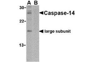 Image no. 1 for anti-Caspase 14, Apoptosis-Related Cysteine Peptidase (CASP14) (C-Term) antibody (ABIN318746) (CASP14 antibody  (C-Term))