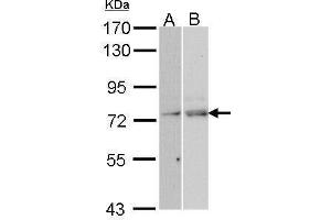 WB Image Sample (30 ug of whole cell lysate) A: Hela B: Molt-4 , 7.