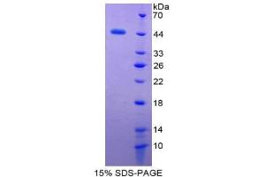 SDS-PAGE (SDS) image for Glycophorin C (GYPC) (AA 1-128) protein (His tag,GST tag) (ABIN2122917) (CD236/GYPC Protein (AA 1-128) (His tag,GST tag))